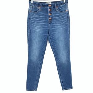 Madewell Button Fly High Rise Stretch Skinny Jeans